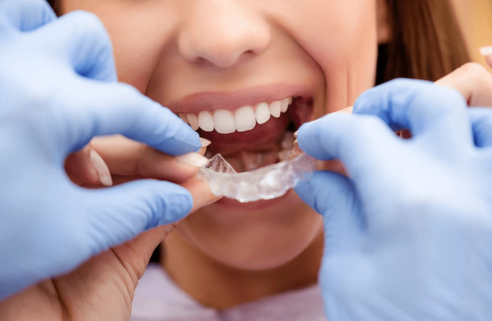 Dentist Maroubra - Total Dental Care | Invisaligninvisalign braces coast