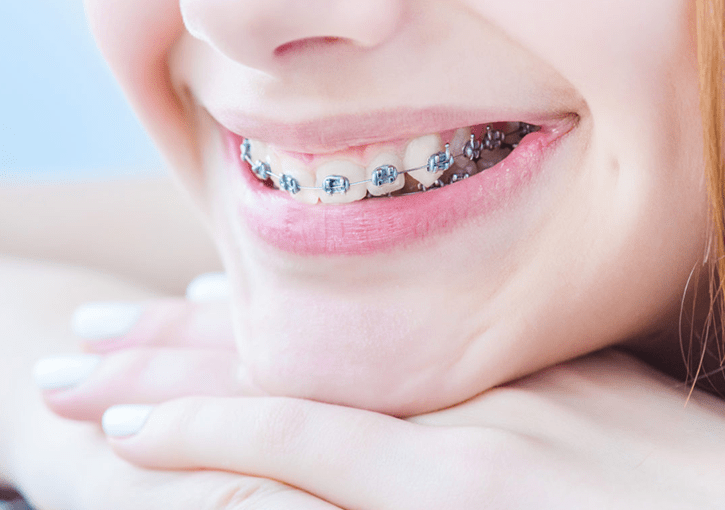 orthodontics service