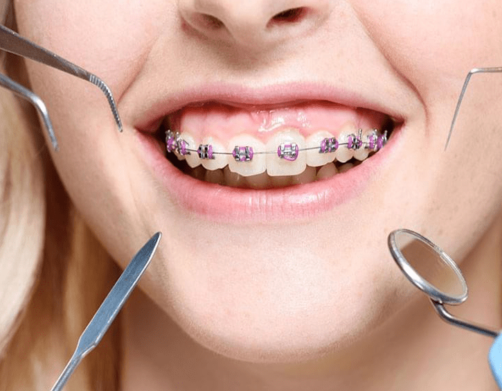 orthodontics clinic in Maroubra